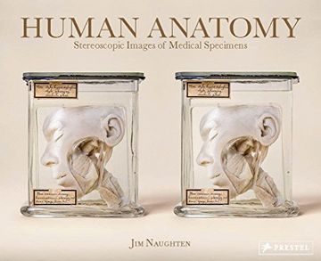 portada Human Anatomy. Stereoscopic Images of Medical Specimens (en Inglés)