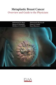 portada Metaplastic Breast Cancer: Overview and Guide to the Physicians