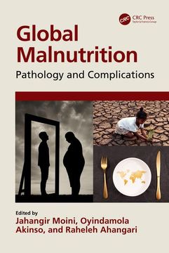 portada Global Malnutrition: Pathology and Complications (en Inglés)