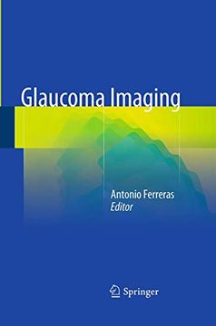 portada Glaucoma Imaging (en Inglés)