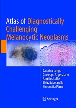 portada Atlas of Diagnostically Challenging Melanocytic Neoplasms (en Inglés)
