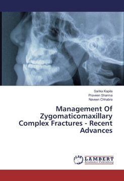portada Management Of Zygomaticomaxillary Complex Fractures - Recent Advances