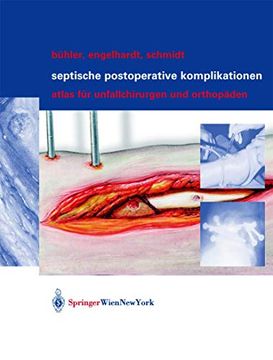 portada Septische Postoperative Komplikationen: Atlas Für Unfallchirurgen Und Orthopäden (en Alemán)