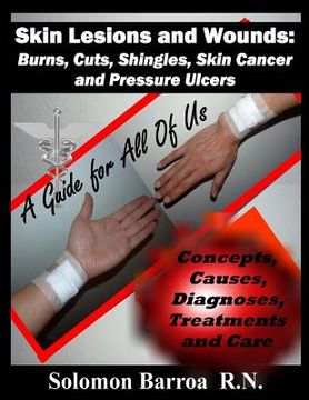 portada Skin Lesions and Wounds: Burns, Cuts, Shingles, Skin Cancer and Pressure Ulcer: ( Concepts, Causes, Diagnoses, Treatment and Care ) (en Inglés)
