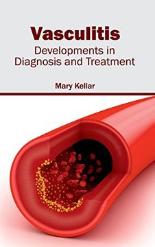portada Vasculitis: Developments in Diagnosis and Treatment (in English)