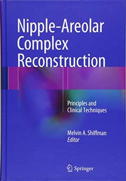 portada Nipple-Areolar Complex Reconstruction: Principles and Clinical Techniques (en Inglés)