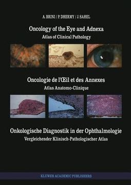 portada Oncology of the Eye and Adnexa / Oncologie de l'Oeil Et Des Annexes / Onkologische Diagnostik in Der Ophthalmologie: Atlas of Clinical Pathology / Atl (en Francés)
