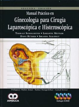 portada Manual Práctico en Ginecología para Cirugía Laparoscópica e Histeroscópica