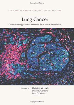 portada Lung Cancer: Disease Biology and its Potential for Clinical Translation (Perspectives Cshl) (en Inglés)