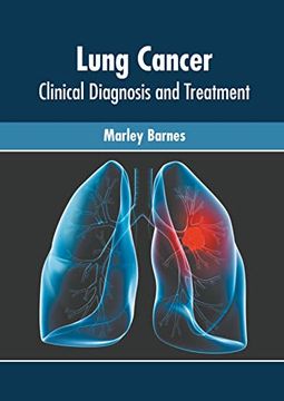 portada Lung Cancer: Clinical Diagnosis and Treatment (en Inglés)