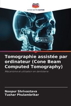 portada Tomographie assistée par ordinateur (Cone Beam Computed Tomography) (en Francés)