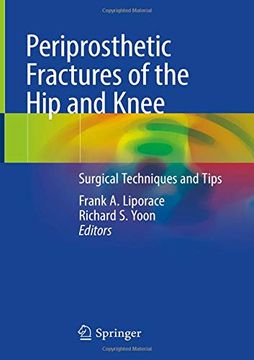 portada Periprosthetic Fractures of the hip and Knee: Surgical Techniques and Tips 
