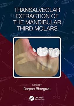 portada Transalveolar Extraction of the Mandibular Third Molars (in English)