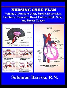 portada Nursing Care Plan (Pressure Ulcer, Stroke, Depression, Fracture, Congestive Heart Failure (Right Side), and Breast Cancer) (Volume 2) 