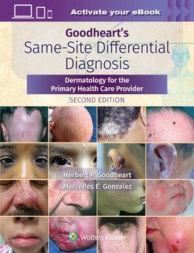 portada Goodheart's Same-Site Differential Diagnosis: Dermatology for the Primary Health Care Provider