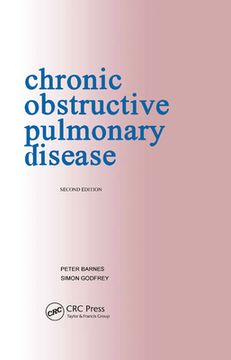 portada Chronic Obstructive Pulmonary Disease: Pocketbook (en Inglés)