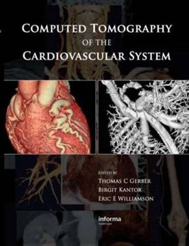 portada Computed Tomography of the Cardiovascular System (en Inglés)