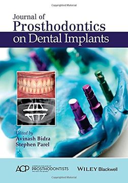 portada Journal of Prosthodontics on Dental Implants