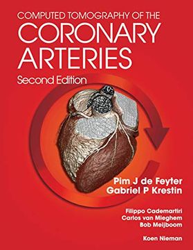 portada Computed Tomography of the Coronary Arteries (en Inglés)