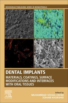 portada Dental Implants: Materials, Coatings, Surface Modifications and Interfaces With Oral Tissues (Woodhead Publishing Series in Biomaterials) (en Inglés)