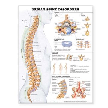 human spine disorders anatomical chart