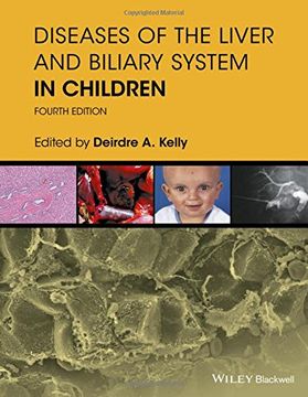portada Diseases of the Liver and Biliary System in Children (en Inglés)
