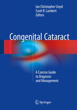 portada Congenital Cataract: A Concise Guide to Diagnosis and Management (in English)