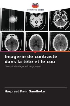 portada Imagerie de contraste dans la tête et le cou (in French)