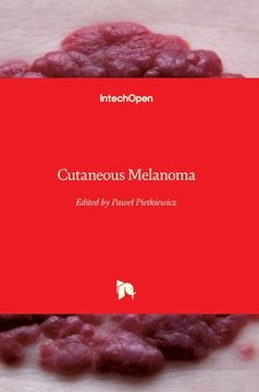 portada Cutaneous Melanoma (in English)