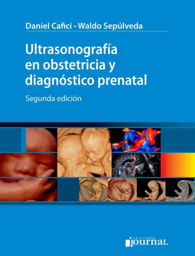 portada Ultrasonografía en Obstetricia y Diagnóstico Prenatal