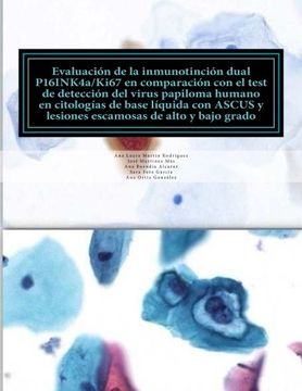 portada EVALUACION DE LA INMUNOTINCION DUAL P16INK4a/Ki67 EN COMPARACION CON EL TEST DEL VIRUS DEL PAPILOMA HUMANO EN CITOLOGIAS DE BASE LIQUIDA CON ASCUS Y ... DE ALTO Y BAJO GRADO (Spanish Edition)