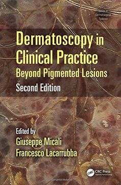 portada Dermatoscopy in Clinical Practice, Second Edition: Beyond Pigmented Lesions (Series in Dermatological Treatment)