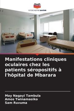 portada Manifestations cliniques oculaires chez les patients séropositifs à l'hôpital de Mbarara (en Francés)