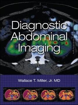 portada Diagnostic Abdominal Imaging (en Inglés)