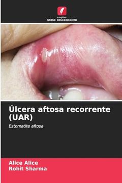 portada Úlcera Aftosa Recorrente (Uar) (en Portugués)