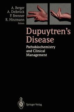 portada dupuytren s disease: pathobiochemistry and clinical management (in English)