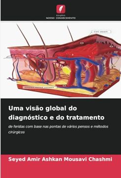 portada Uma Visão Global do Diagnóstico e do Tratamento: De Feridas com Base nas Pontas de Vários Pensos e Métodos Cirúrgicos (en Portugués)