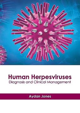 portada Human Herpesviruses: Diagnosis and Clinical Management (en Inglés)