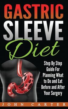 portada Gastric Sleeve Diet: Step By Step Guide For Planning What to Do and Eat Before and After Your Surgery (en Inglés)