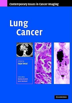 portada lung cancer