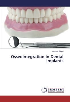 portada Osseointegration in Dental Implants