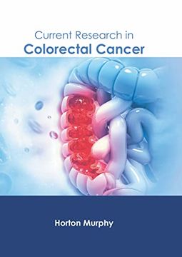 portada Current Research in Colorectal Cancer (en Inglés)