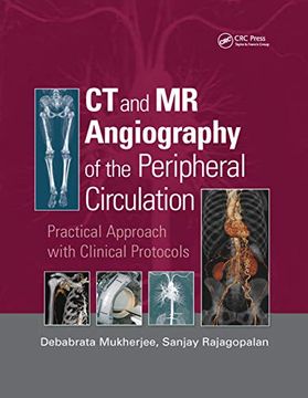 portada Ct and mr Angiography of the Peripheral Circulation: Practical Approach With Clinical Protocols 