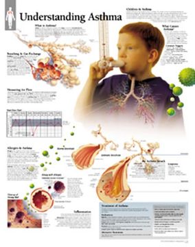 portada understanding asthma chart: wall chart (en Inglés)