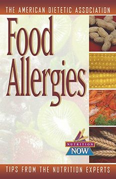 portada Food Allergies: The Nutrition now Series (in English)