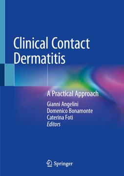 Clinical Contact Dermatitis: A Practical Approach (en Inglés)