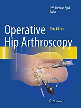 portada Operative Hip Arthroscopy