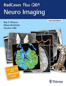 portada Radcases Plus q&a Neuro Imaging (en Inglés)