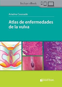 portada Atlas de Enfermedades de la Vulva