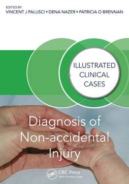 portada Diagnosis of Non-Accidental Injury: Illustrated Clinical Cases (en Inglés)
